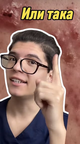 Видео в TikTok за хормонално акне и Боуен терапия